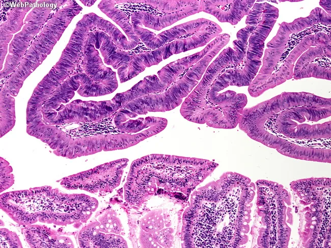 Ampulla Of Vater Histology