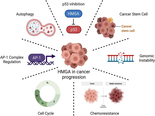 Lipoma : Role of HMGA2