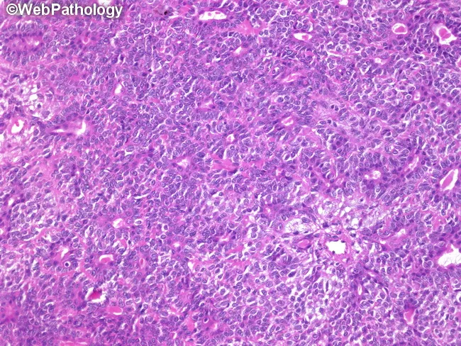 parotid gland histology pathology outlines