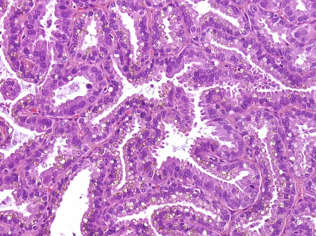 seminal vesicle histology drawing