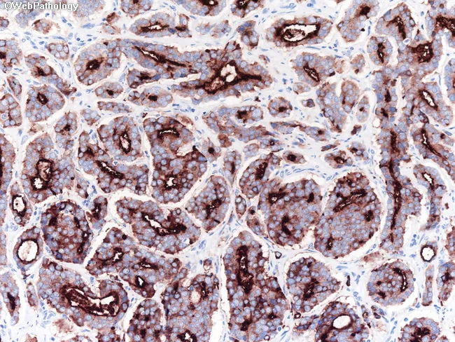 AFIP4th #14 Tumors of the Prostate(新本) Tumors of the Prostate Gland, Seminal Vesicles, Penis, and Scrotum