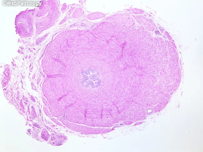 Vas deferens