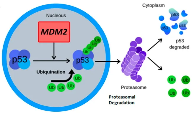 Atypical Lipomatous Tumor/Well-Diff Liposarcoma : MDM2 Amplification