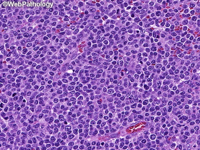MEITL : Microscopic Features