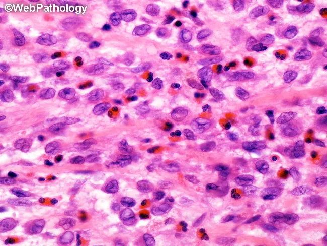 LCH : Morphology