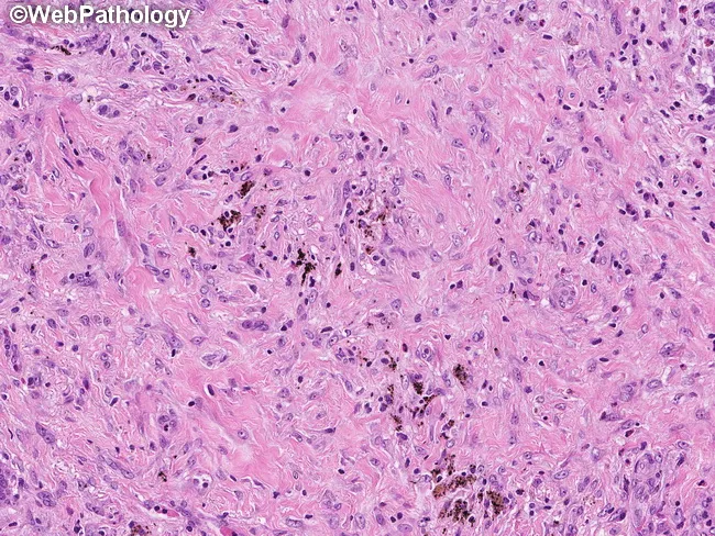 LCH : Morphology