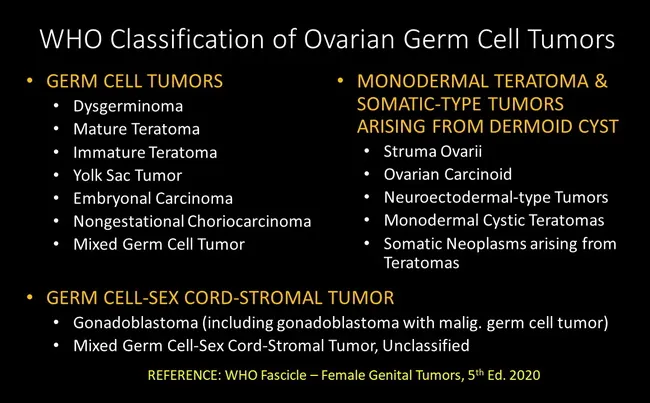 What Is Germ Cell Ovarian Cancer