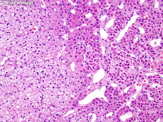 adrenal gland histology pathology outlines