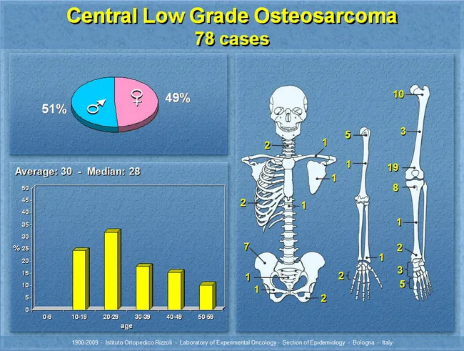 Low-Grade Central Osteosarcoma