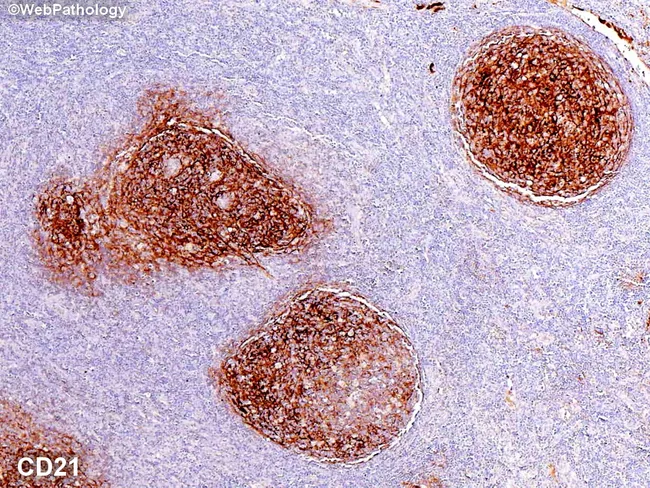 Normal Lymph Node: CD21