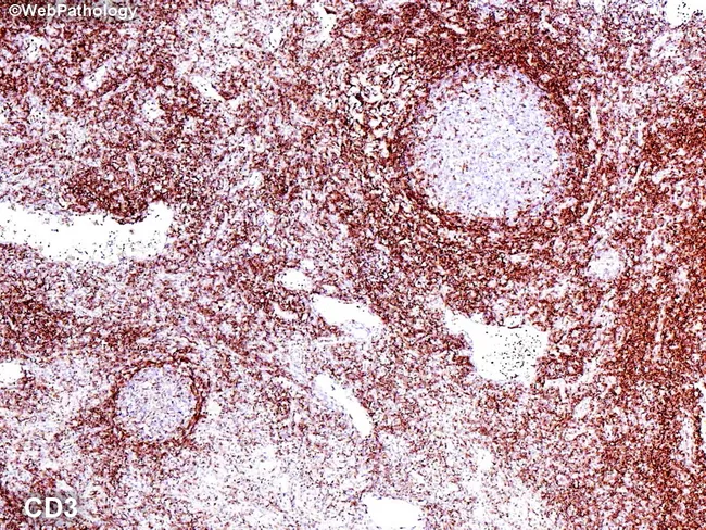 Normal Lymph Node: CD3