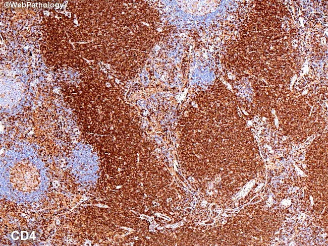 Normal Lymph Node: CD4