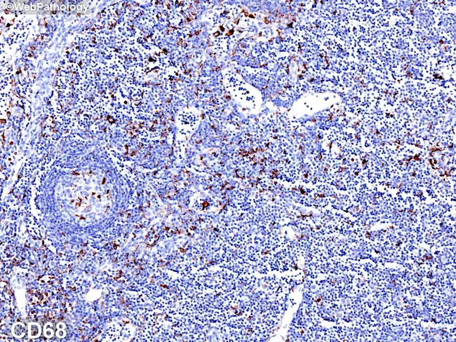 Normal Lymph Node: CD68