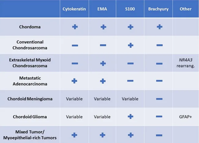 Chordoma: Differential Diagnosis